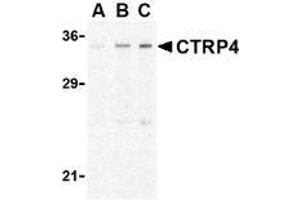 Western blot analysis of CTRP4 in rat brain cell lysate with AP30253PU-N CTRP4 antibody at (A) 1, (B) 2, and (C) 4 μg/ml. (C1QTNF4 Antikörper  (N-Term))