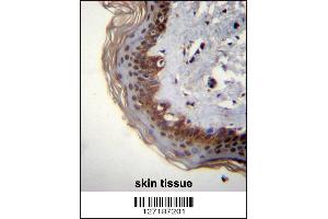 RBM42 Antibody immunohistochemistry analysis in formalin fixed and paraffin embedded human skin tissue followed by peroxidase conjugation of the secondary antibody and DAB staining. (RBM42 Antikörper  (C-Term))