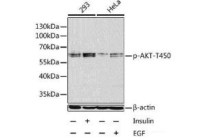 Western blot analysis of extracts of 293 and HeLa cells using Phospho-AKT(T450) Polyclonal Antibody at dilution of 1:1000. (AKT1 Antikörper  (pThr450))