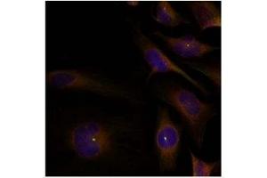 Image no. 1 for anti-Cofilin 1 (CFL1) (Tyr88) antibody (ABIN319381) (Cofilin Antikörper  (Tyr88))