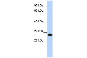 WB Suggested Anti-PSMA2 Antibody Titration: 0. (PSMA2 Antikörper  (N-Term))