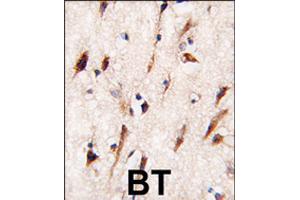 Formalin-fixed and paraffin-embedded human brain tissue reacted with MOBKL1A polyclonal antibody  , which was peroxidase-conjugated to the secondary antibody, followed by DAB staining . (MOBKL1A Antikörper  (C-Term))