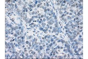 Image no. 2 for anti-Fc Fragment of IgG, Low Affinity IIa, Receptor (CD32) (FCGR2A) antibody (ABIN1497259)