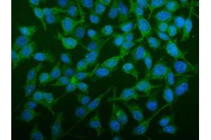 IF analysis of SEC14L3/TAP2 using anti-SEC14L3/TAP2 antibody (ABIN7601623). (SEC14L3 Antikörper  (AA 4-400))