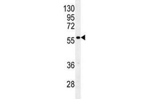 Glypican 3 antibody western blot analysis in mouse stomach tissue lysate (Glypican 3 Antikörper  (AA 21-50))