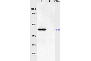 L1 mouse brain lysates L2 human colon carcinoma lysates probed with Anti - phospho-JNK1/2/3 (Thr183+Tyr185) Polyclonal Antibody, Unconjugated (ABIN732368) at 1:200 in 4 °C.
