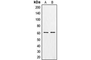 Western blot analysis of CSGALNACT1 expression in MCF7 (A), K562 (B) whole cell lysates. (CSGALNACT1 Antikörper  (Center))