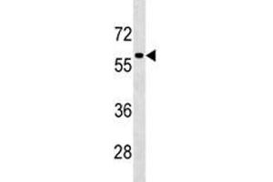 TFEB antibody western blot analysis in HepG2 lysate. (TFEB Antikörper  (AA 271-300))