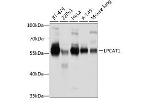 Western blot analysis of extracts of various cell lines, using LPC antibody (ABIN6130983, ABIN6143295, ABIN6143296 and ABIN6220819) at 1:1000 dilution.