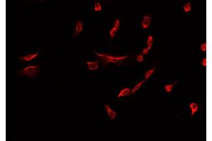 ABIN6277934 staining HepG2? (Nestin Antikörper  (C-Term))