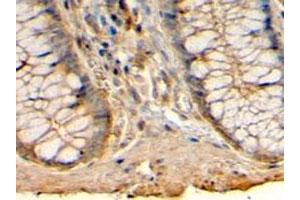 HRH1 polyclonal antibody (Cat # PAB6855, 4 ug/mL) staining of paraffin embedded human colon. (HRH1 Antikörper)