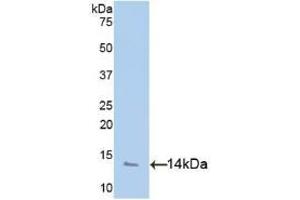 Detection of Recombinant PF4, Human using Polyclonal Antibody to Platelet Factor 4 (PF4) (PF4 Antikörper  (AA 31-101))
