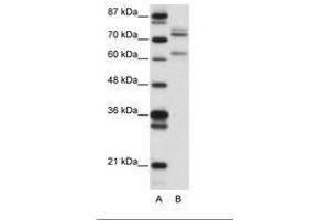 Image no. 1 for anti-GATA Zinc Finger Domain Containing 2B (GATAD2B) (AA 61-110) antibody (ABIN6736149) (GATAD2B Antikörper  (AA 61-110))