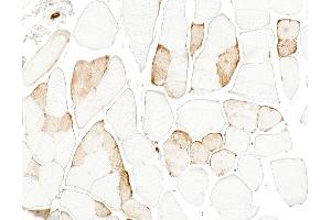 Immunohistochemistry (IHC) image for anti-Myoglobin (MB) antibody (ABIN7795605) (Myoglobin Antikörper)