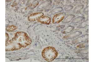 Immunoperoxidase of monoclonal antibody to TLN1 on formalin-fixed paraffin-embedded human small Intestine. (TLN1 Antikörper  (AA 1052-1149))