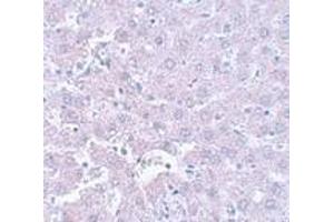 Immunohistochemistry of CALHM1 in rat liver tissue with CALHM1 antibody at 5 μg/ml. (CALHM1 Antikörper  (N-Term))