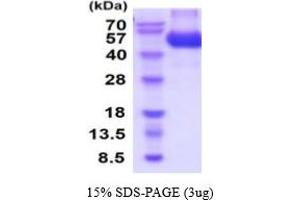 SDS-PAGE (SDS) image for Ciliary Neurotrophic Factor Receptor (CNTFR) (AA 23-342) protein (His tag) (ABIN5854746) (CNTF Receptor alpha Protein (AA 23-342) (His tag))