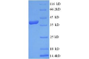 SDS-PAGE (SDS) image for Dermcidin (DCD) (AA 20-110) protein (GST tag) (ABIN5709387) (Dermcidin Protein (DCD) (AA 20-110) (GST tag))
