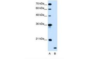 Image no. 1 for anti-Ring Finger Protein 175 (RNF175) (AA 58-107) antibody (ABIN341280) (RNF175 Antikörper  (AA 58-107))