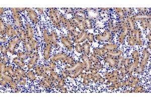 Immunohistochemistry (IHC) image for anti-Fatty Acid Binding Protein 1, Liver (FABP1) (AA 2-127) antibody (ABIN7433792)