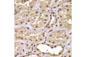Immunohistochemistry of paraffin-embedded human kidney using CSRP2BP antibody (ABIN5975516) at dilution of 1/100 (40x lens). (CSRP2BP Antikörper)