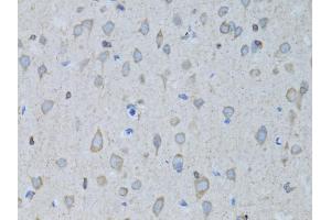 Immunohistochemistry of paraffin-embedded rat brain using GABARAP antibody (ABIN5973270) at dilution of 1/100 (40x lens). (GABARAP Antikörper)