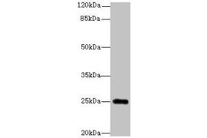 Western blot All lanes: GOSR2 antibody at 4 μg/mL + Jurkat whole cell lysate Secondary Goat polyclonal to rabbit IgG at 1/10000 dilution Predicted band size: 25, 23 kDa Observed band size: 25 kDa (GOSR2 Antikörper  (AA 1-190))