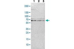 Western Blot (Cell lysate) analysis with TRAF3 polyclonal antibody  Lane 1: NIH-3T3 cell lysate (Mouse embryonic fibroblast cells) Lane 2: NBT-II cell lysate (Rat Wistar bladder tumour cells) Lane 3: PC12 cell lysate (Pheochromocytoma of rat adrenal medulla) (TRAF3 Antikörper)