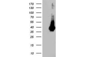 HEK293T cells were transfected with the pCMV6-ENTRY control (Left lane) or pCMV6-ENTRY LDLRAP1 (Right lane) cDNA for 48 hrs and lysed. (LDLRAP1 Antikörper)