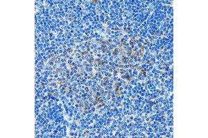 Immunohistochemistry of paraffin-embedded rat spleen using PAICS antibody. (PAICS Antikörper  (AA 176-425))