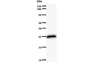 Western Blotting (WB) image for anti-Centromere Protein C 1 (CENPC1) antibody (ABIN932451)