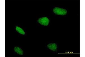 Immunofluorescence of purified MaxPab antibody to ZBTB32 on HeLa cell. (ZBTB32 Antikörper  (AA 1-302))