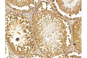 ABIN6262174 and ABIN6269018 at 1/100 staining Rat testis tissue by IHC-P. (HDAC10 Antikörper  (N-Term))