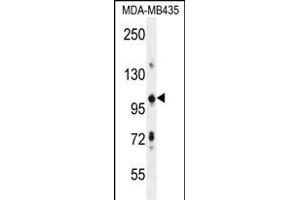 TRIM33 Antibody (C-term) (ABIN655994 and ABIN2845376) western blot analysis in MDA-M cell line lysates (35 μg/lane).