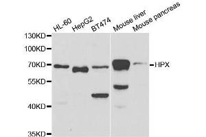 Western blot analysis of extracts of various cell lines, using HPX antibody. (Hemopexin Antikörper  (AA 24-245))