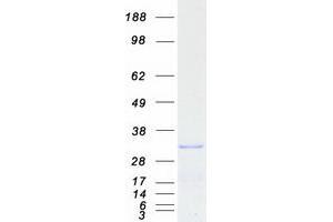 REEP3 Protein (Myc-DYKDDDDK Tag)