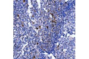 IHC analysis of NCR1 using anti-NCR1 antibody (ABIN7602013).