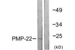 Western blot analysis of extracts from MDA-MB-435 cells, using PMP22 Antibody. (PMP22 Antikörper  (AA 111-160))