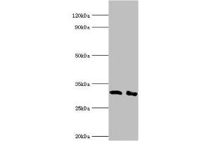 Western blot All lanes: Lymphocyte function-associated antigen 3 antibody at 2 μg/mL Lane 1: Hela whole cell lysate Lane 2: Jurkat whole cell lysate Secondary Goat polyclonal to rabbit IgG at 1/10000 dilution Predicted band size: 29, 27, 28 kDa Observed band size: 29 kDa (CD58 Antikörper  (AA 40-220))