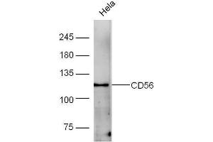 Human HeLa lysates probed with Rabbit Anti-CD56 Polyclonal Antibody, Unconjugated  at 1:5000 for 90 min at 37˚C.