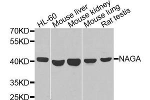 Western blot analysis of extracts of various cells, using NAGA antibody. (NAGA Antikörper)