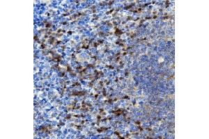 IHC analysis of NOXA2/p67phox/NCF2 using anti-NOXA2/p67phox/NCF2 antibody (ABIN7599462). (NCF2 Antikörper  (AA 1-526))