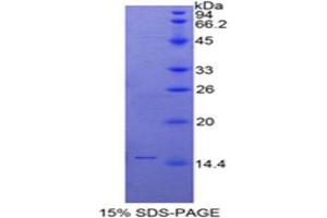 SDS-PAGE analysis of Human SLURP1 Protein. (SLURP1 Protein)