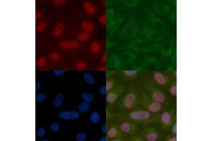 Apc11 Mouse Monoclonal Antibody staining Hela cells by IF/ICC. (ANAPC11 Antikörper)