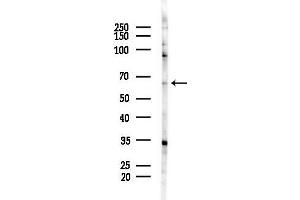 anti-Acyl-CoA Synthetase Medium-Chain Family Member 3 (ACSM3) (N-Term) antibody