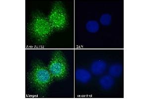 ABIN308459 Immunofluorescence analysis of paraformaldehyde fixed A431 cells, permeabilized with 0. (AUTS2 Antikörper  (C-Term))
