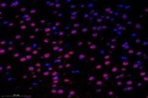 Immunofluorescent analysis of paraformaldehyde-fixed mouse substantia nigra using,SUN2 (ABIN7075502) at dilution of 1: 1000 (SUN2 Antikörper)