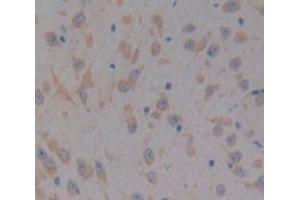 IHC-P analysis of Kidney tissue, with DAB staining. (PTK2B Antikörper  (AA 704-941))