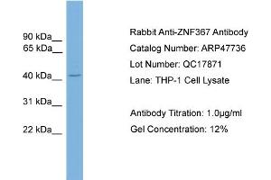 WB Suggested Anti-ZNF367  Antibody Titration: 0. (ZNF367 Antikörper  (C-Term))