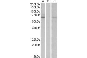HEK293 lysate (10ug protein in RIPA buffer) over expressing Human MKRN1 with DYKDDDDK tag probed with Makorin Antibody  (1 µg/ml) in Lane A and probed with anti- DYKDDDDK Tag (1/1000) in lane C. (MKRN1 Antikörper  (Internal Region))